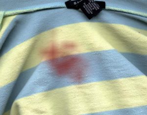 Como tirar manchas de roupas manchadas por outras roupas