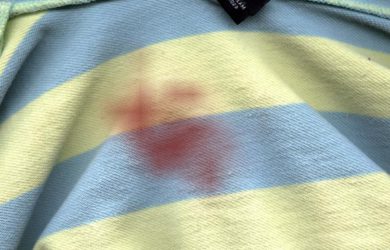 Vinagre para remover Manchas
