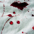Remover nódoa de sangue seco