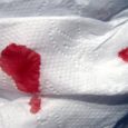 Tirar manchas de sangue em algodão