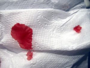 Tirar manchas de sangue