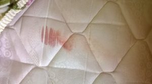 Aprenda a Tirar Mancha de Sangue do Colchão de Maneira Fácil